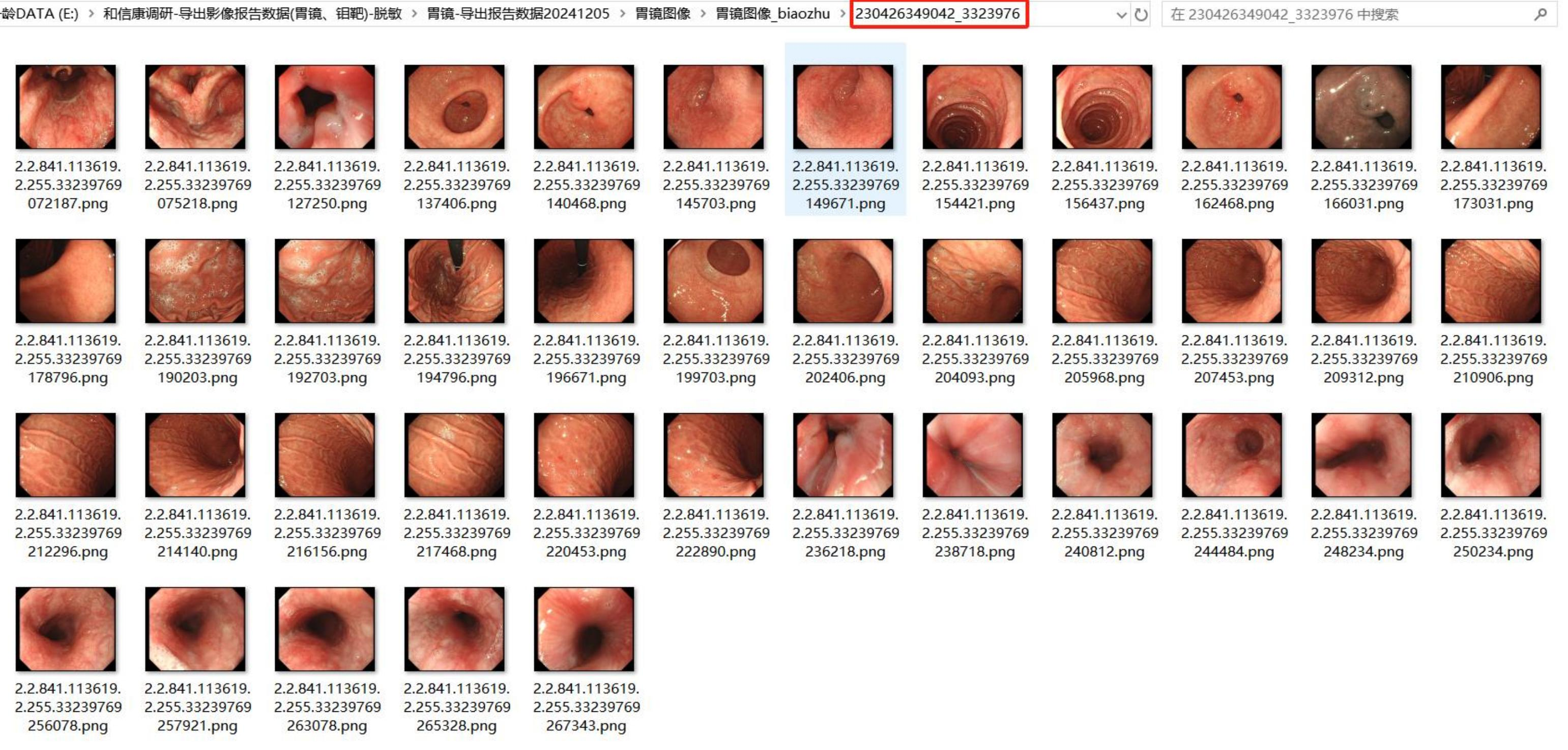 朗慧科技推出专业化胃镜影像智能标注解决方案，助力消化道疾病AI精准诊断